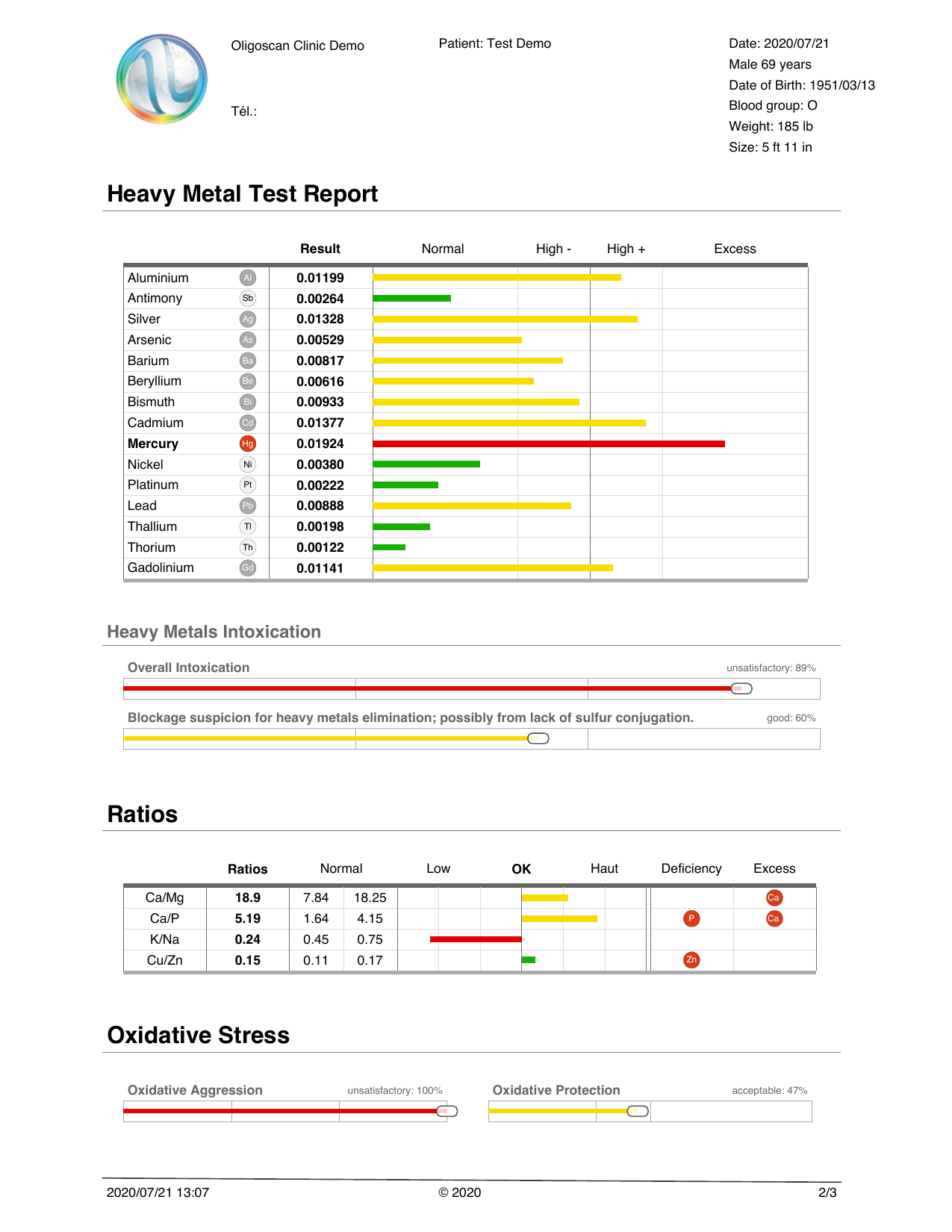 OligoScan sample report showing mineral and heavy metal analysis